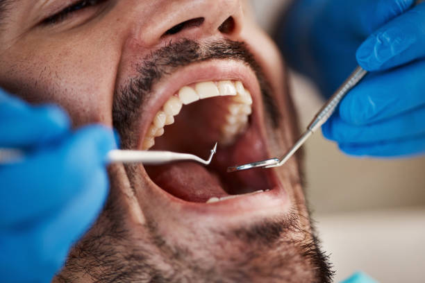Best Emergency Gum Treatment in Topaz Ranch Estates, NV
