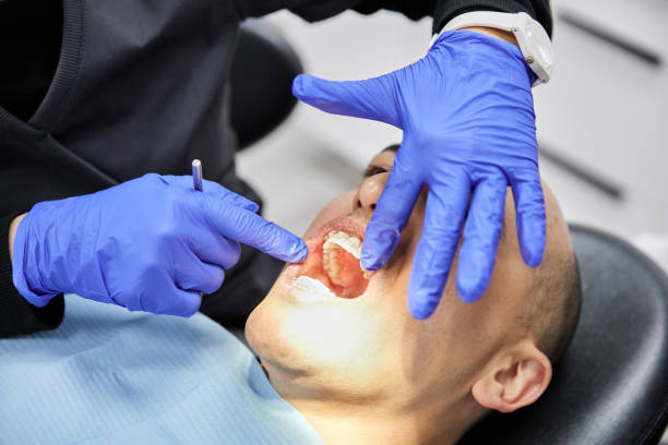 Best Emergency Dental Care for Broken or Chipped Teeth in Topaz Ranch Estates, NV