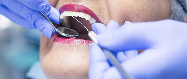 Best Emergency Tooth Extraction in Topaz Ranch Estates, NV